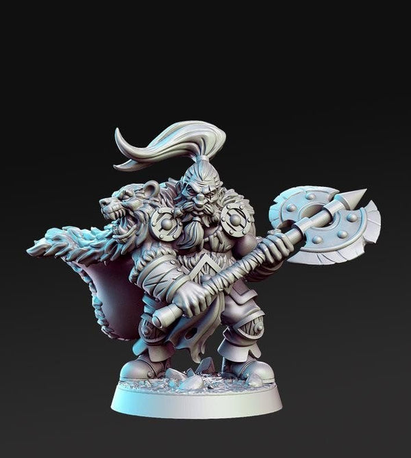 Ortwayn 3D-printed model