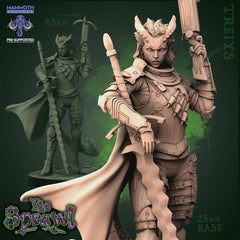 Treiys 3D-printed model
